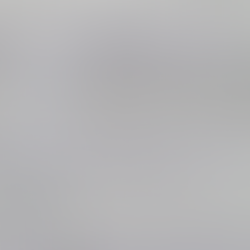 전형적 당뇨 증상 및 현성 단백뇨를 동반한 당뇨피부병증, 진정한 노력도 포함하여 3일만에... - 동대문구 답십리, 장안동, 우리안애 우리안愛 내과