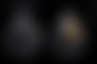 심방세동 환자, 흉골연골염에 의한 우측 흉곽 아래 흉통에 대해 우상복부 평가 및 간략한 이첨반 관찰