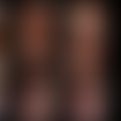 의식하 진정내시경은... 그때그때 다르다 - 동대문구 답십리, 사근동, 우리안애 우리안愛 내과