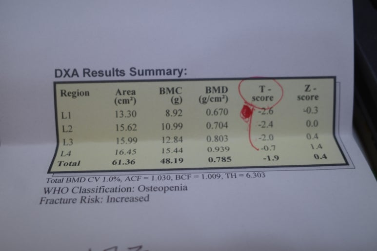진료의 당황스러움 (2); 골다공증은 아닌데? 보건소는 뭐하는 곳? - 동대문구 답십리, 전농동, 우리안애 우리안愛 내과
