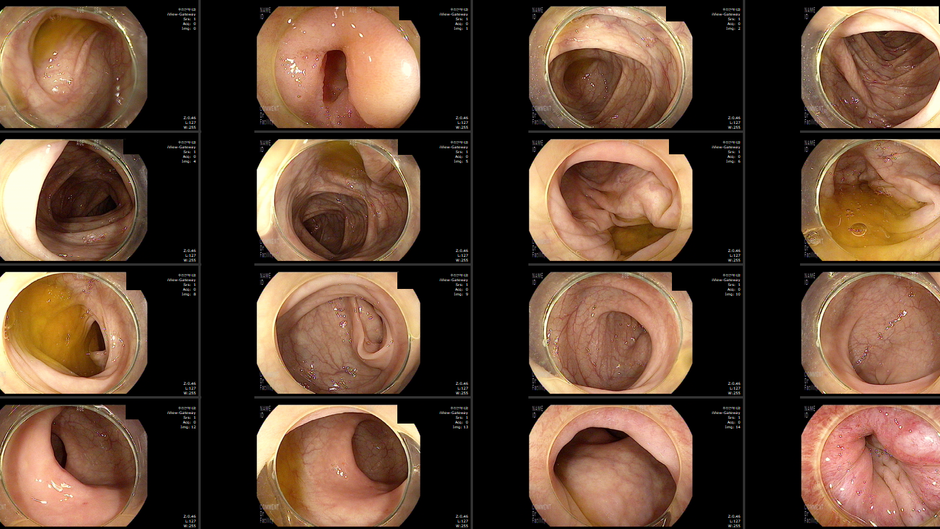 대장내시경 위해 방문하신 타병원 소화기내과 선생님 - 동대문구 답십리, 청량리동, 우리안애 우리안愛 내과