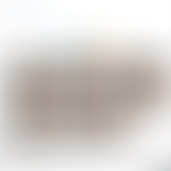 초음파 창이 좋지 않은 환자에서 이전 간결절이 안보이며 혈소판 감소가 진행하여 의뢰하여 간 CT, 간탄성도 (fibroscan) 촬영