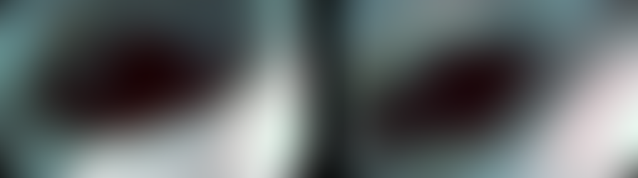 삼킴 통증, 연하통 양상의 흉통 호소한 약제유발 식도염 의증