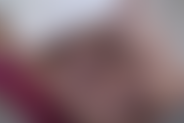 울혈반모양혈관병증... 대학병원 피부과를 꾸준히 추적하게 되었으나 (2)... 부종은 갑상선 호르몬 투약의 누락으로 밝혀짐 - 동대문구 답십리, 전농동, 우리안애 우리안愛 내과