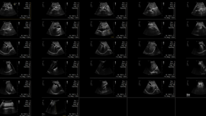 술고래 30대! 금주하고 내원, 앞으로도 유지할 생각으로 - 동대문구 답십리, 하왕십리동, 우리안애 우리안愛 내과