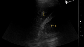 기술하는 CT 소견이 확인되지 않거나, 언급이 없었을까? 소견이 있거나... - 동대문구 답십리, 전농동, 우리안애 우리안愛 내과