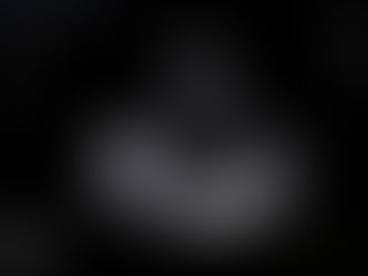 접종 후 심근염 의증; 혈액검사는 정상이나 증상과 경도의 심실 확장에서 확진검사 상담위해 의뢰 - 동대문구 답십리, 전농동, 우리안애 우리안愛 내과