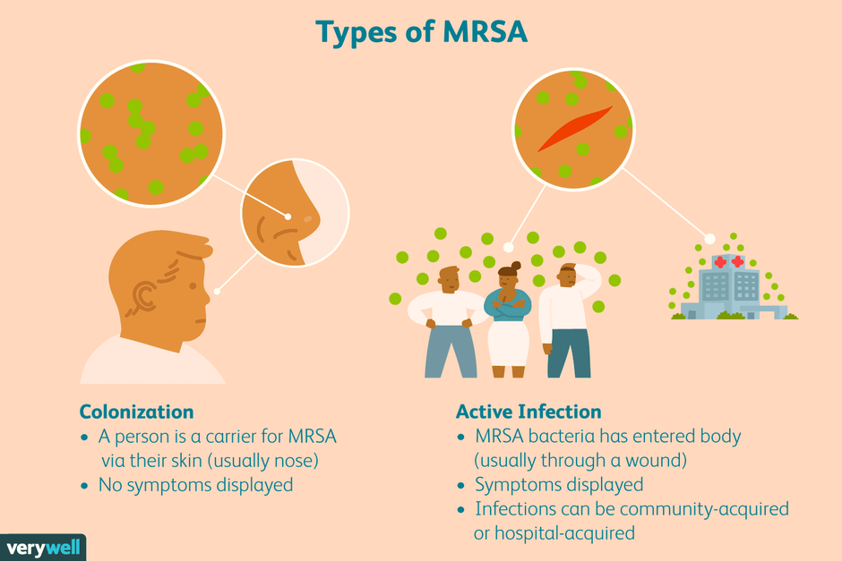 활동성 결핵 환자에서 MRSA, 메티실린 내성 황색포도상구균 보균, 집락형성 확인, 투약 중 가래에 결핵균 여부 추적 - 동대문구 답십리, 장안동, 우리안애 우리안愛 내과