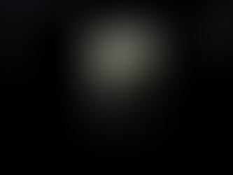 과거 게실염 배경에 압통? .. 초음파후 배제, 그냥 눌려서로 판단 - 동대문구 답십리, 전농동, 우리안애 우리안愛 내과