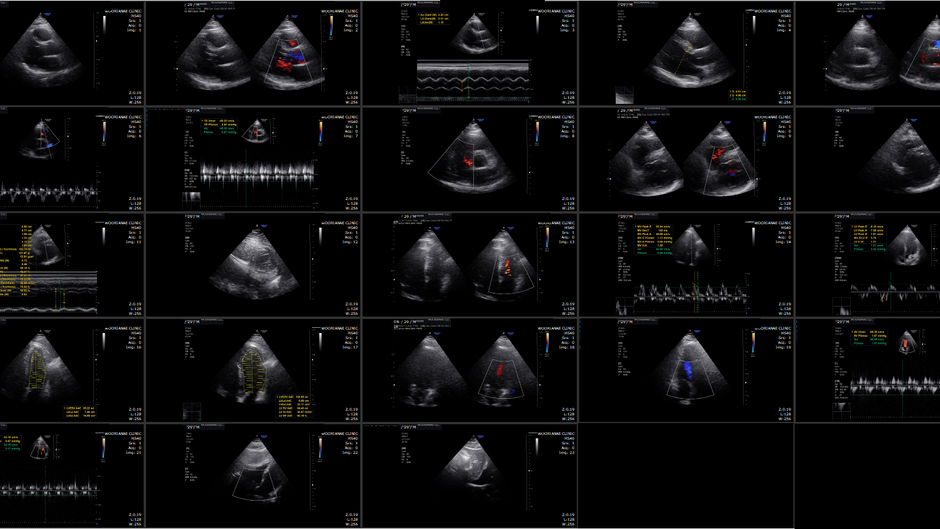 심장초음파 대기가 길다? 코로나 접종시대에서... - 동대문구 답십리, 장안동, 우리안애 우리안愛 내과