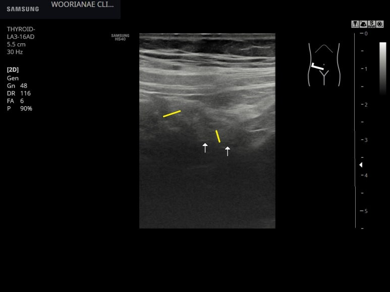 실제 방문 이유는? 의 구별 + 알콜/독성 간염에서 간 주변의 증상 (2) - 동대문구 답십리, 장안동, 우리안애 우리안愛 내과