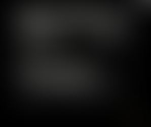 병원간 관찰소견의 차이로 내원; 무명동맥의 동맥경화, 단기간 끊으면 큰일난다고 할 정도인가? - 동대문구 답십리, 신수동, 우리안애 우리안愛 내과