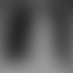 컨디션은 좋아보이는데 폐포음의 청진때문에 확인; 고령의 폐렴 - 동대문구 답십리, 전농동, 우리안애 우리안愛 내과