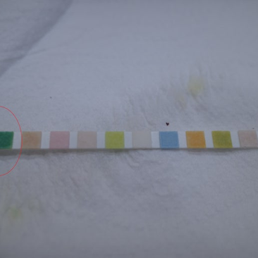 초기에 고열과 오한, 소변증상은 약하나 의미있는... 복잡 요로감염의 판단, 배양음성 - 동대문구 답십리, 전농동, 우리안애 우리안愛 내과