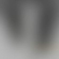 초기부터 폐렴이었던 환자의 추적, 발열은 소실되고 흉부촬영 호전을 확인 - 동대문구 답십리, 용답동, 우리안애 우리안愛 내과