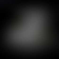 육안적 혈뇨, 과거와 같은 통증이 아니라 요로결석이라고 생각하지 않으며 방문, 수신증/요로 확장이 없는 방광요도이행부 결석 - 동대문구 답십리, 전농동, 우리안애 우리안愛 내과