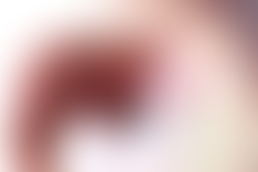 세균성 인후염의 판단 (3), 최근의 편도염, 그리고 다시 연구개쪽 궤양의 발생 - 동대문구 답십리, 전농동, 우리안애 우리안愛 내과