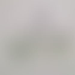 관찰을 피해간 식후 고혈당 (당화혈색소는 불량하나), 연속혈당계로 확인, 복합인슐린으로 변경 계획 - 동대문구 답십리, 장안동, 우리안애 우리안愛 내과