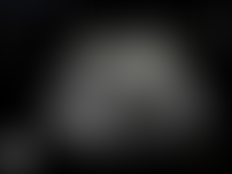 좌하복부 복통/압통, 복막수염으로 rule-in - 동대문구 답십리, 전농동, 우리안애 우리안愛 내과