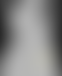 1주일 이상 위내에 머물러 있다 빠져서 내려오는 위내 이물, 동전 - 동대문구 답십리, 장안동, 우리안애 우리안愛 내과