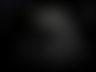 고령의 세균성 장염, 구역감의 감별, 지방간에 의한 오래된 변화? 설명 - 동대문구 답십리, 전농동, 우리안애 우리안愛 내과