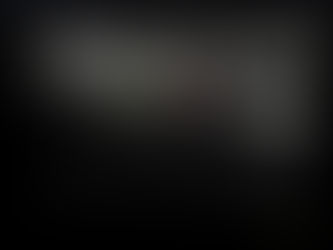 턱의 촉지되는 림프절이 커졌다? 로 방문, 초음파로 확인