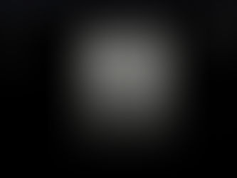 왼쪽 국소적 통증/압통, 복막수염 의심하여 초음파 소견 확인