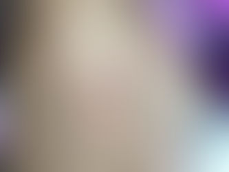 오른쪽 전흉부 통증 호소, 문진이 어려웠던 대상포진 의증 --> 늑연골염 --> 대상포진 진단; 6-7일의 통증후 피부병변이 발생한 대상포진 사례