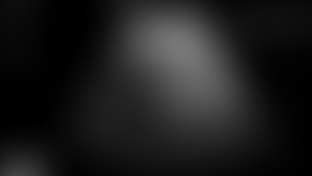 담낭 절제 배경에서 우상복부 통증, 총담관석 - 동대문구 답십리, 행당동, 우리안애 우리안愛 내과