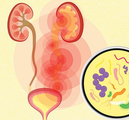 방광염 처방 후 ... 수일 지나 오한/발한/근육통으로 감기 진료로 접수, 치료실패 후 진행하는 복잡요로감염으로 판단 - 동대문구 답십리, 전농동, 우리안애 우리안愛 내과