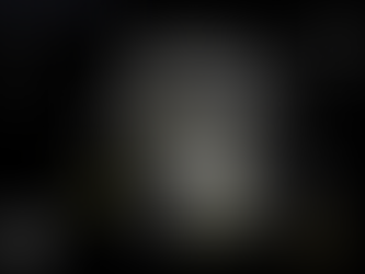 게실염 걱정하고 내원, 자궁내막종 수술 기왕력 배경에서 난소에 내막종 및 출혈성 낭종이 동시에 - 동대문구 답십리, 용답동, 우리안애 우리안愛 내과