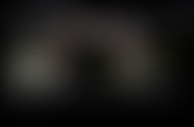 체중증가, 변비, 머리가 빠진다...위축성 갑상선염, 씬지로이드 투약중이나... 용량 조절 필요