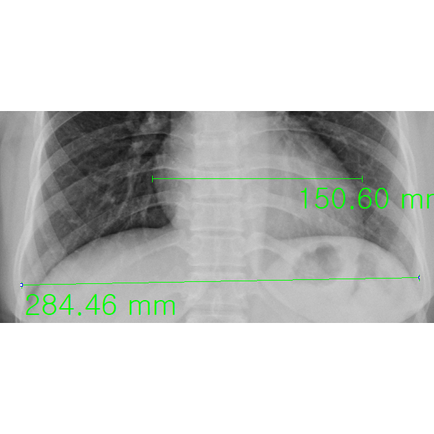 심한 빈혈에 의한 고출력, high-output 심장이 지속된다면.. - 동대문구 답십리, 용답동, 우리안애 우리안愛 내과