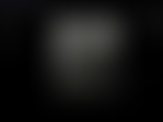 과거 게실염 입원력 환자의 복통, 초음파를 통한 게실염 확인 - 동대문구 답십리, 전농동, 우리안애 우리안愛 내과