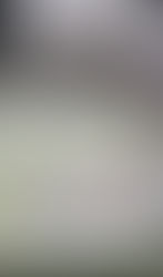 소변 요당 강양성, 1~2년이내 발생한 당뇨로 판단됨