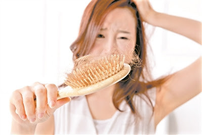 雄激素性脫髮原因