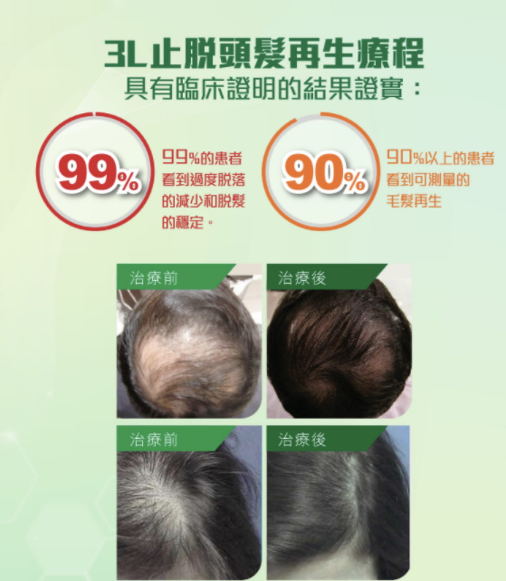 3L生髮效果
