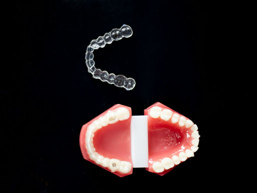 Why Invisalign in Dubai Is a Preferred Solution for Discreet and Effective Teeth Straightening