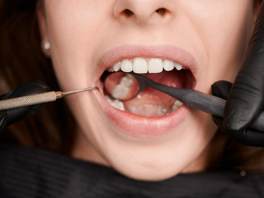 What to Expect Before and After a Tooth Removal Procedure
