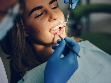 The Role of Dental Bonding in Restoring Chipped, Gapped, and Uneven Teeth