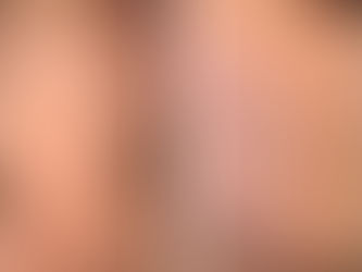 3 Phasic System, medicina estetica Pescara