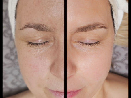 Új koreai kezelés - 42 Red Collagen