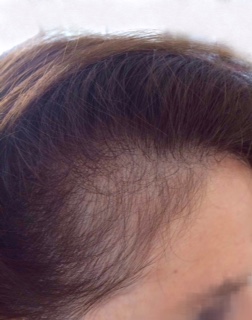 cliente di 45 anni