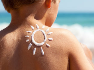 Four Remedies to Help Treat Sunburn Discomfort