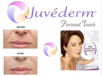 juvederm.jpg