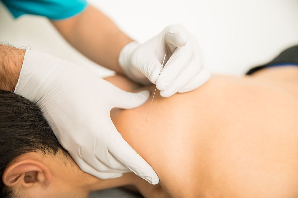 closeup-shirtless-man-receiving-dry-needling-therapy-from-doctor-clinic.jpg
