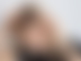a woman with dandruff in her hair