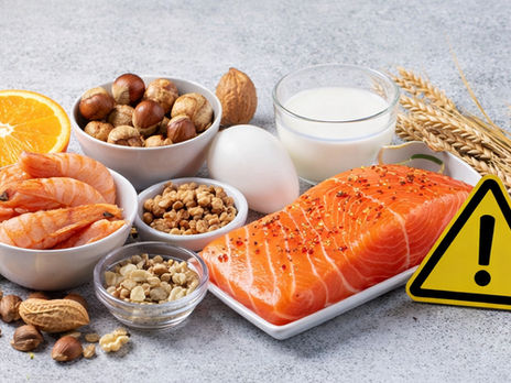 Food Allergen Control for Catering Level 2 International Qualification