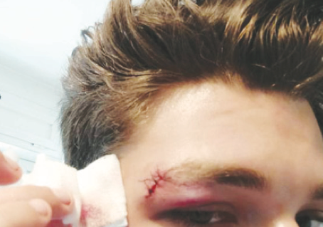 Aggressione
a Trastevere:
rintracciati
4 squadristi