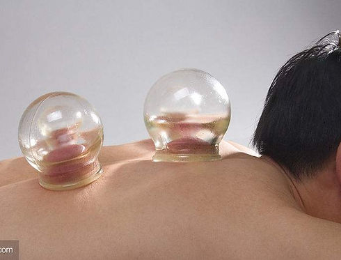 cupping.jpg